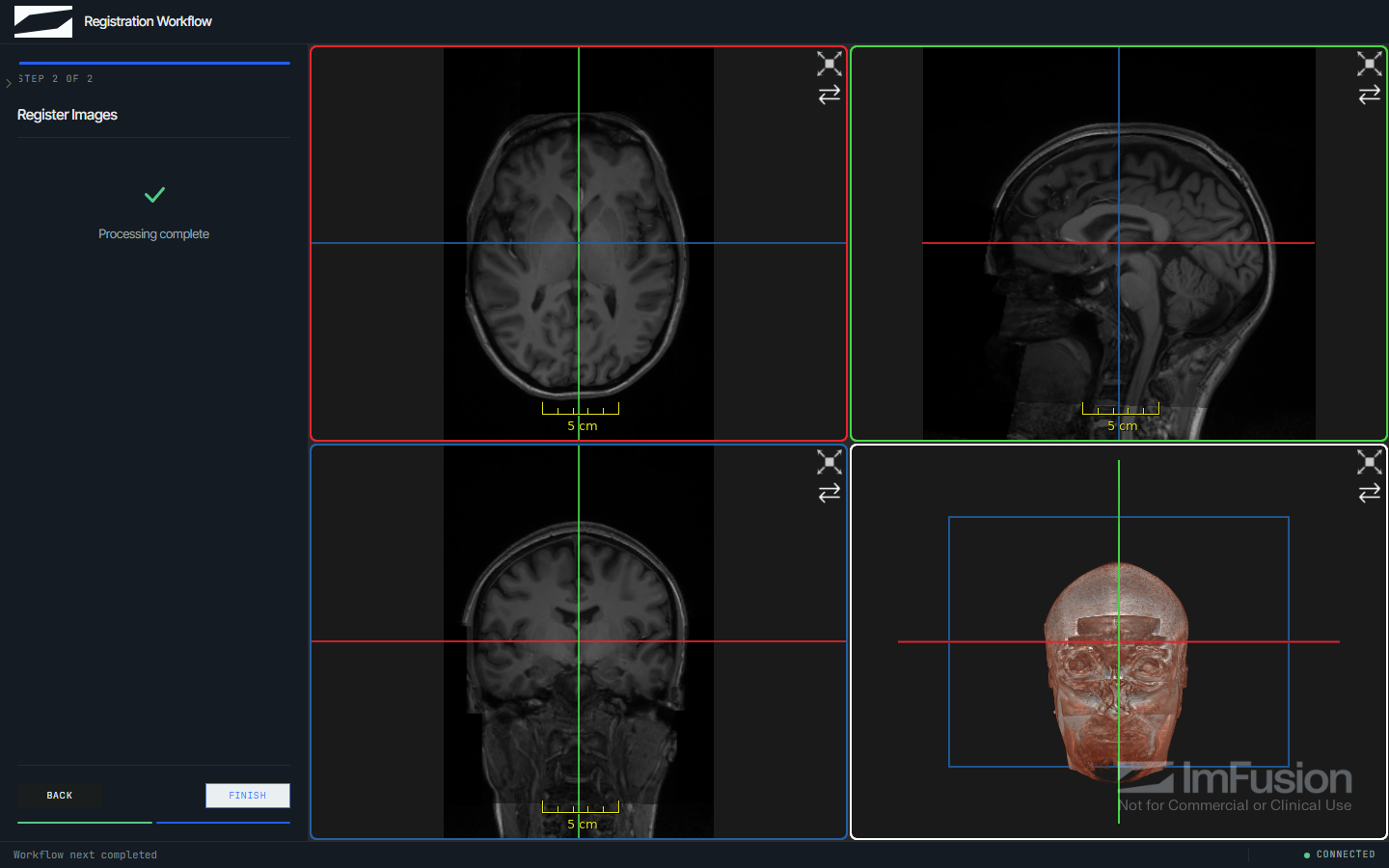 The registration demo after running, with three orthogonal views, a 3D rendering, and the result listed under the two input sessions