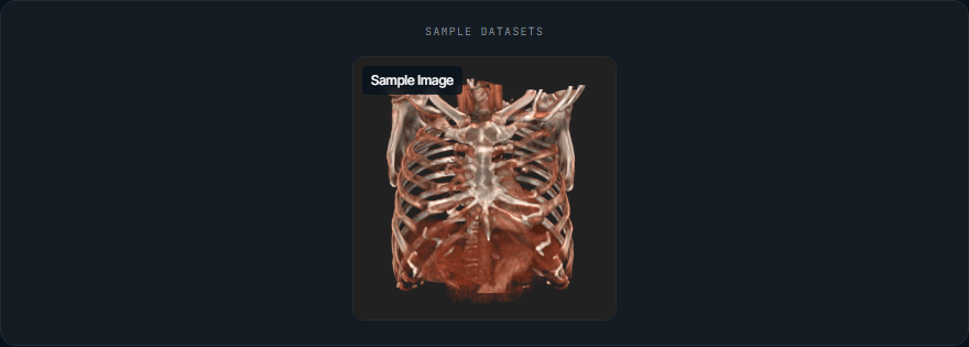 Sample dataset card with a thumbnail on the landing page