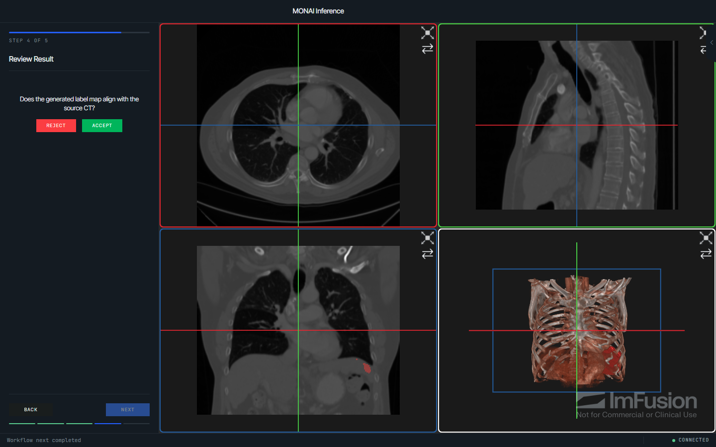 The template after inference, with the generated label map over the source CT and a review step asking whether it aligns