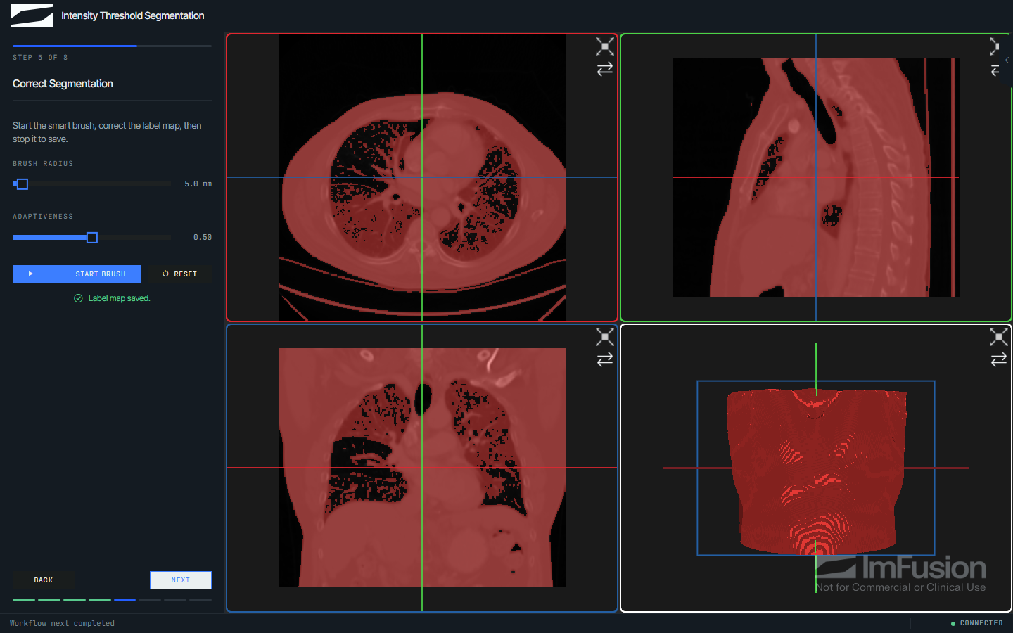 Brush step with radius and adaptiveness controls beside the label map in the viewer