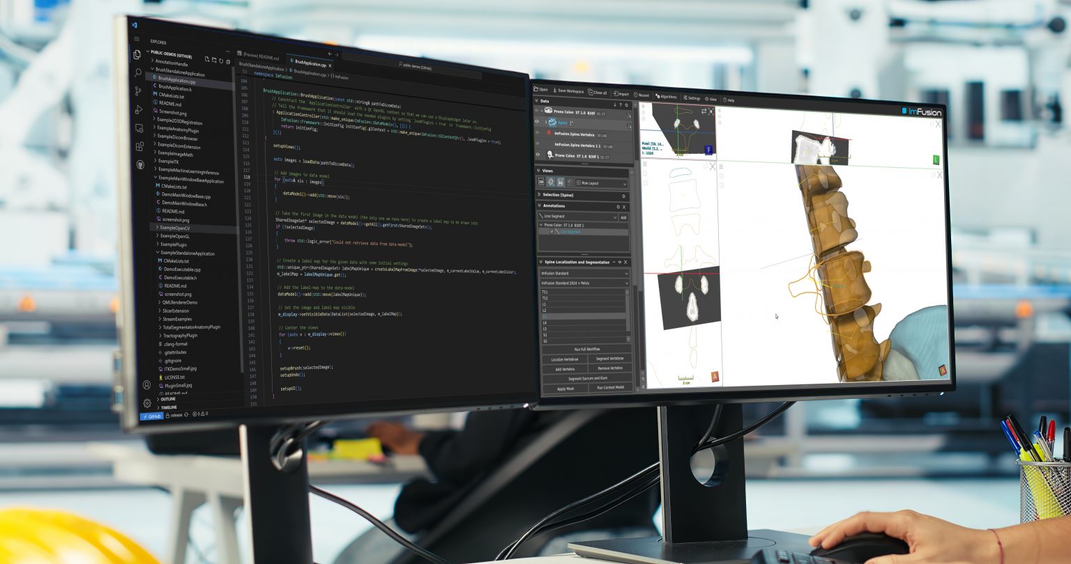 ImFusion rapid prototyping interface shown on a monitor with medical imaging views and workflow panels